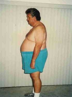 Rapid weight loss